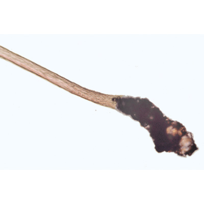 Structure fine du cuir chevelu, cheveux sains et malades - Anglais, 1004268 [W13443], Préparations microscopiques LIEDER