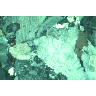 Lames minces de roches, petite sêrie II, 1012498 [W13455], Préparations microscopiques LIEDER