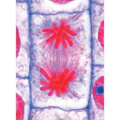 JUEGO MULTIMEDIAL DEL PROFESOR División Celular (Mitosis y Meiosis) Colección básica con 6 preparaciones, 1004353 [W13741], Micropreparados LIEDER