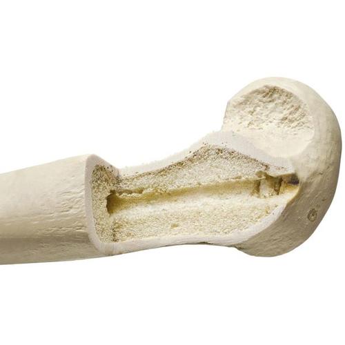 ORTHObones 的右尺骨, 1005123 [W19127], 3B ORTHObones高级版模型产品
