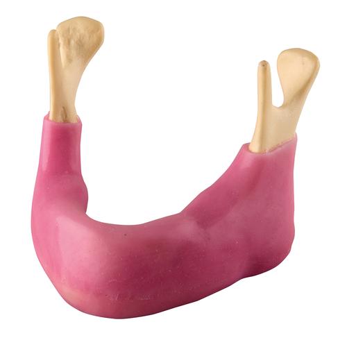 牙列缺失的下颌牙龈, 1018330 [W19136], 3B ORTHObones高级版模型产品