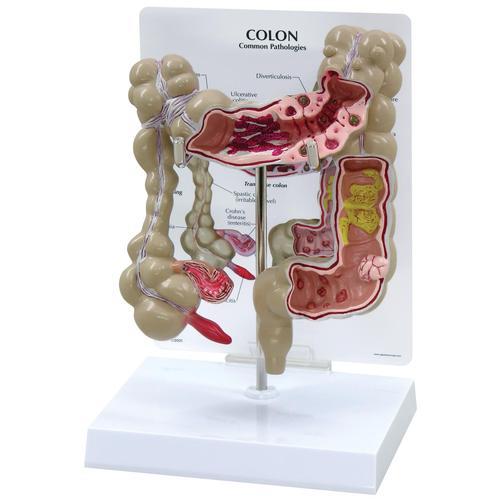 Модель толстой кишки, 1019554 [W33364], Модели пищеварительной системы человека