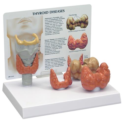 갑상선 모형 Thyroid Model, 1019548 [W33370], 머리 모형