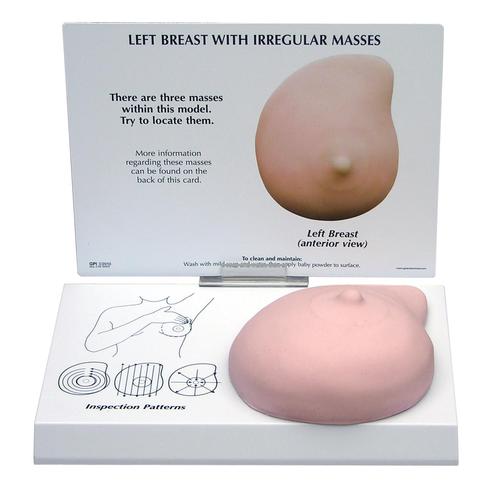 Modèle de sein gauche avec masses irrégulières, 1019558 [W33385], Modèles mammaires