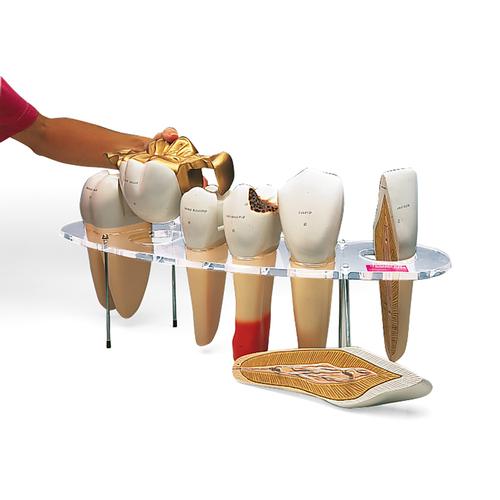 Modèle de prothèse dentaire, en 7 parties, agrandie 10 fois - Anglais, 1005540 [W42517], Modèles dentaires