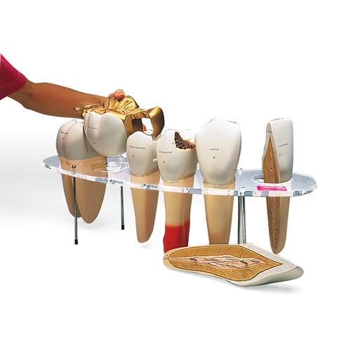 Modelo de pr&oacute;tesis dental, 7 piezas, 10 veces su tama&ntilde;o natural - Ingl&eacute;s, 1005540 [W42517], Modelos dentales