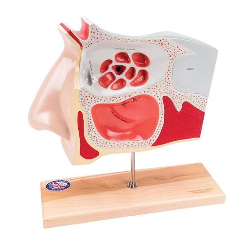 Modelo de explicación de endoscopia del seno, 2 piezas - inglés, 1005542 [W42525], Modelos de Oído, Laringe y Nariz