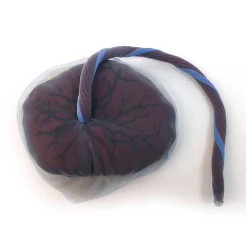 Modelo de placenta e cord&atilde;o umbilical, 1005573 [W43039], Educa&ccedil;&atilde;o: Sa&uacute;de da Mulher