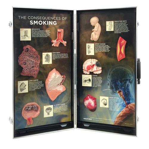 3D吸烟后果展示架, 1005580 [W43047], 吸烟教育示意图
