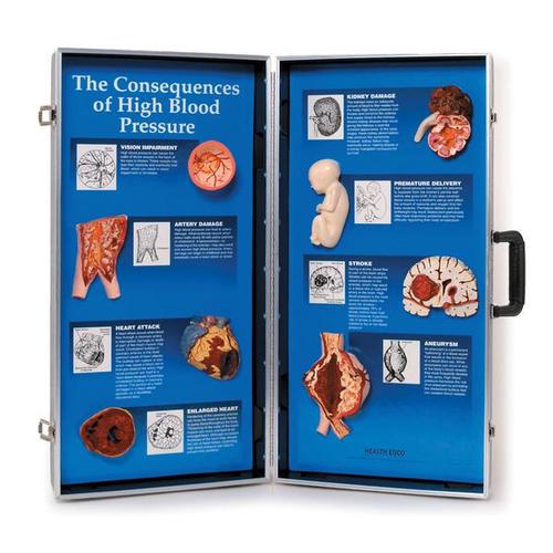 Mostrador de Consequências de Hipertensão Arterial, 1018277 [W43081], Informações sobre saúde e fitness