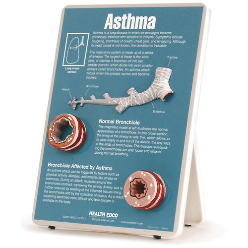 Asthma Easel Display, 1018278 [W43083], Обучение по вопросам бронхиальной астмы и аллергии