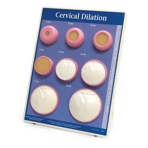 Cervical Dilation Easel Display, 1012488 [W43093], Pregnancy and Childbirth Education