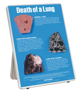 Death of a Lung Easel Display, 3004660 [W43111], Tobacco Education