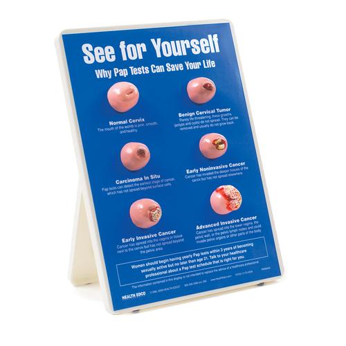 See For Yourself: Pap Tests Easel Display, 1018296 [W43132], Women's Health Education
