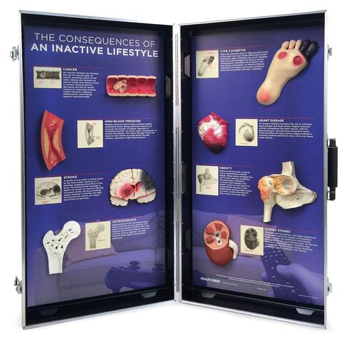 Expositor Consecuencias de
un estilo de vida inactivo, 1018300 [W43147], Educaci&oacute;n sobre salud y fitness cardiacos