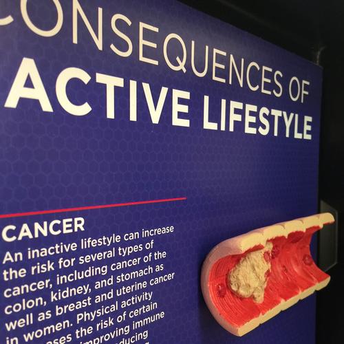 Consequences of An Inactive Lifestyle 3D Display, 1018300 [W43147], Obesity and Eating Disorders Education