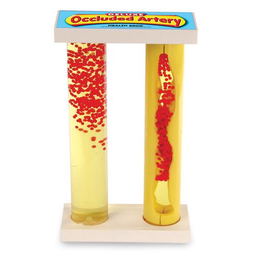 Deluxe Occluded Artery Model, 3004734 [W43206D], Heart Health and Fitness Education