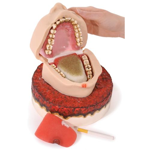 Smoker's Foul Mouth Display, 3004757 [W43234], Tobacco Education
