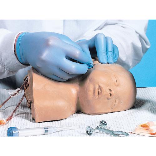 Cabe&ccedil;a pedi&aacute;trica, 1005630 [W44101], Inje&ccedil;&otilde;es e Pun&ccedil;&atilde;o