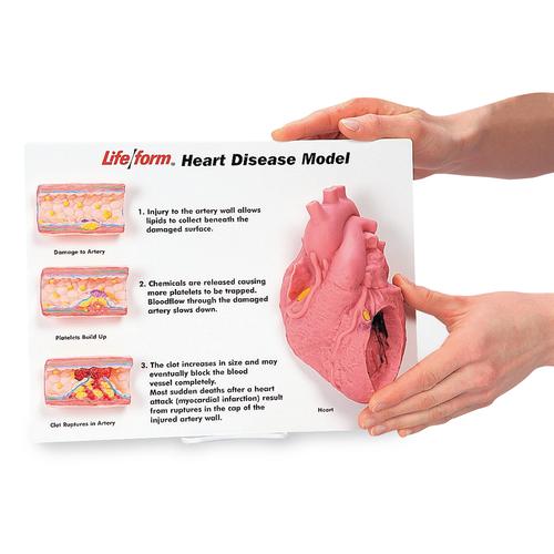 Heart Disease Display Kit, 3004476 [W44780], Heart Health and Fitness Education