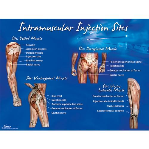 Cartaz de Locais de Inje&ccedil;&atilde;o Intramuscular, 1018427 [W44783], Intramuscular (I.m.) e Intrad&eacute;rmico