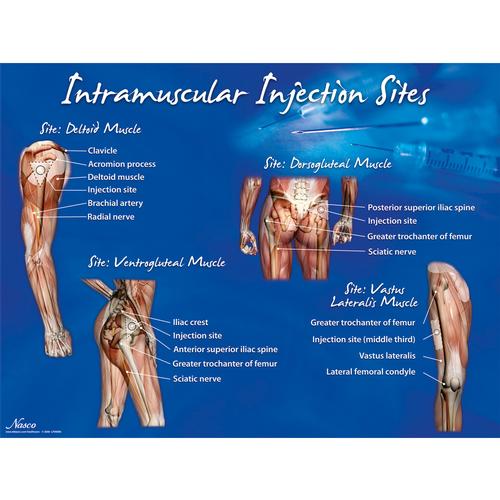 근육 주사 부위 포스터  Intramuscular Injection Sites Poster, 1018427 [W44783], 주사실습 및 천자