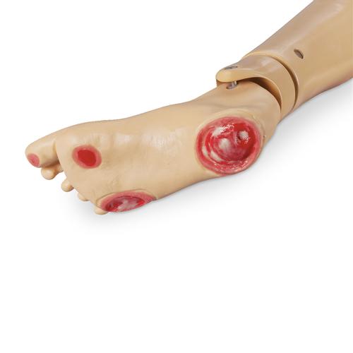 Geri and KERi Pressure Ulcer Foot, 1017985 [W44784F], Geriatric Patient Care