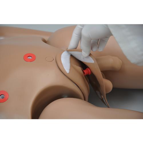 Simulador de Cuidados com Paciente Clinical Chloe™ com Estomas Esculpidas, 1017542 [W45052], Cuidados com Ostomia