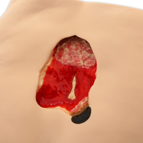 Seymour II&trade; Simulador de tratamiento de dec&uacute;bito, 1009798 [W46500/1], Cuidado dec&uacute;bito