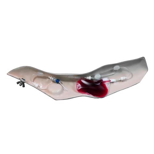 고급형 Chester Chest, 가벼운 피부를 위한  팔  Advanced Arm for Chester Chest, Light Skin, 1005840 [W46511], 전문 외상처치술