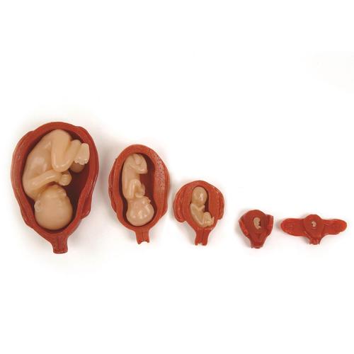 Uterus/Fetus Model Set (5), 3004840 [W99999-509], Pregnancy Models