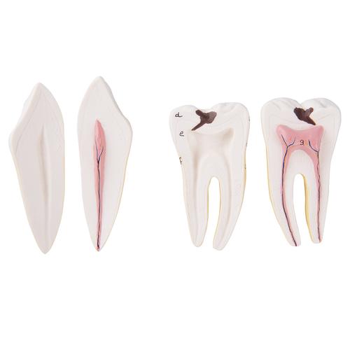 Reposição do dente canino e molar para D25, 1020688 [XD001], Peças de reposição