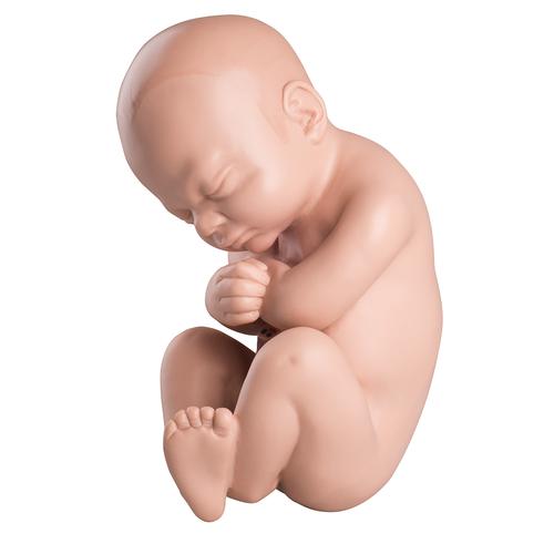 Reposição do feto para L20, 1020700 [XL001], Peças de reposição