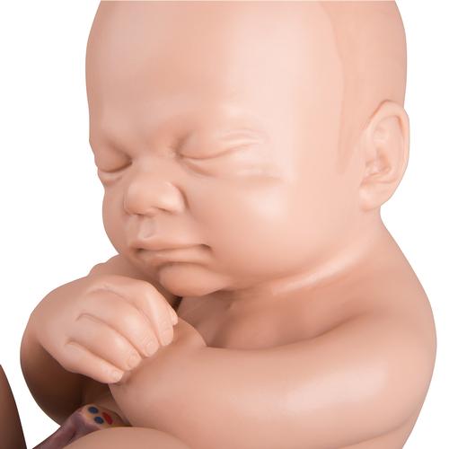 备用胎儿，用于L20, 1020700 [XL001], 替代品