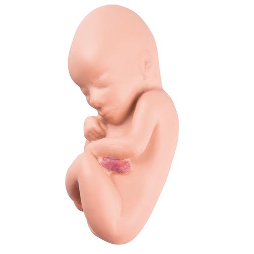 Ersatz Fetus für L10/4, 1018629 [XL002], Ersatzteile