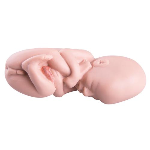 备用胎儿，用于L10/5, 1018634 [XL003], 替代品