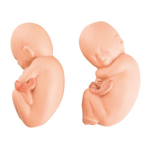 Fœtus de rechange pour modèle de fœtus jumeaux à 5 mois de grossesse, 1020702 [XL005], Pièces de rechange