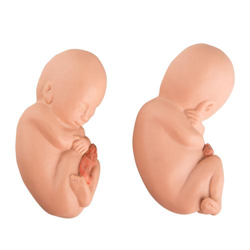Replacement fetuses for twin fetus model in the fifth month, 1020702 [XL005], Replacements