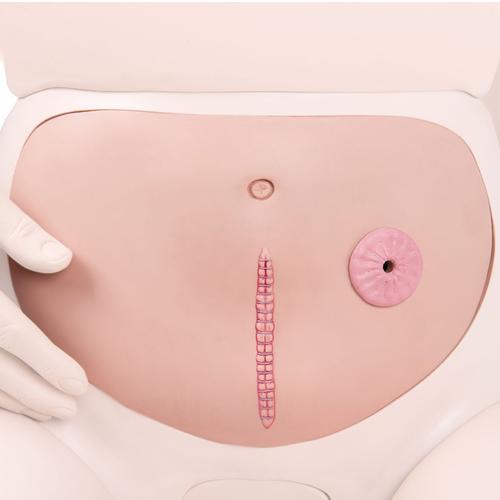 Abdominal Wall with Staple Suture, 1018810 [XP007/1], Options