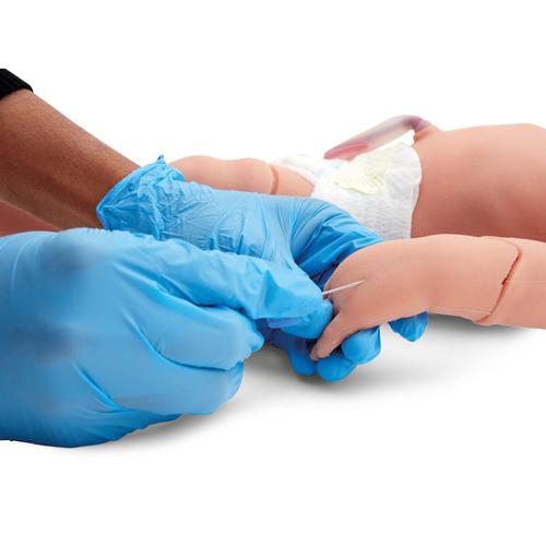 Atlas Baby Bra&ccedil;o para Infus&atilde;o IV, Pele Clara (5 Unidades), 1025675 [XP77-003], Consum&iacute;veis