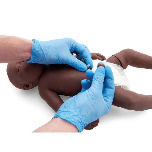 Atlas Baby Coto Umbilical, Pele Escura (10 Unidades), 1025674 [XP77D-002], Pe&ccedil;as de reposi&ccedil;&atilde;o