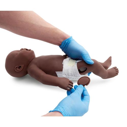 Atlas Baby Inser&ccedil;&atilde;o IM, Pele Escura (10 Unidades), 1025680 [XP77D-005], Consum&iacute;veis
