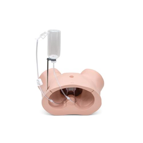 Conjunto de Atualiza&ccedil;&atilde;o SPC para P93 PRO, 1023012 [XP93SPC-002], Cateteriza&ccedil;&atilde;o