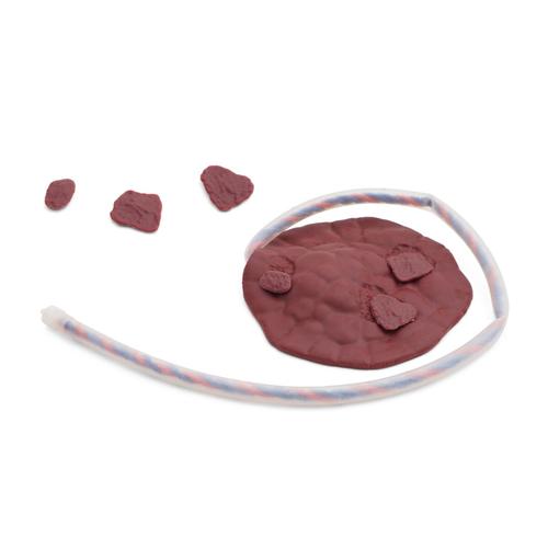 Placenta with 2 sets of residual pieces, 1023763 [XP97P-003], Replacements
