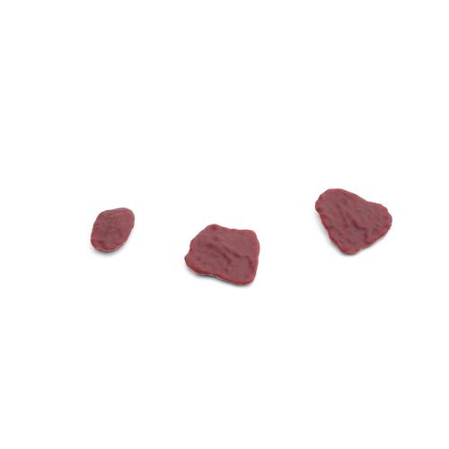 Placenta residual pieces 1 set, 1023764 [XP97P-004], Replacements