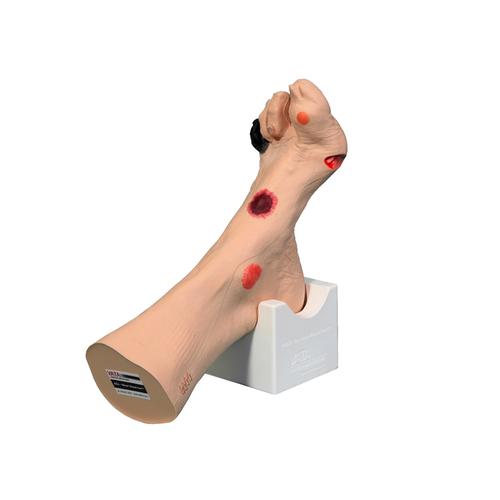 Wilma 상처 발™  Wilma Wound Foot™, 1017978 [w46516], 욕창간호