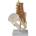 Pelvic Model with Lumbar Spine Muscles, 1019418, Joint Models
