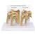 Modelo de Ombro com Osteoartrose (OA) em 4 estágios, 1019514, Modelo de articulações (Small)