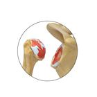4 Stage Osteoarthritis (OA) Shoulder Model, 1019514, Joint Models (Small)