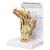 类风湿性关节炎手模型, 1019521, 胳膊和手骨骼模型 (Small)